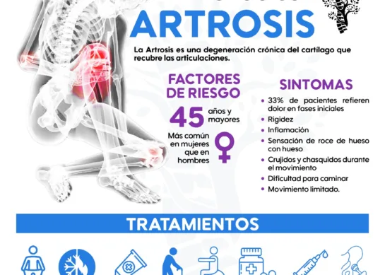 La artrosis